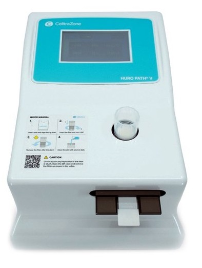 Liquid Cytology